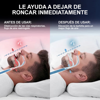 Elimina los ronquidos desde la primera noche con SilencePro